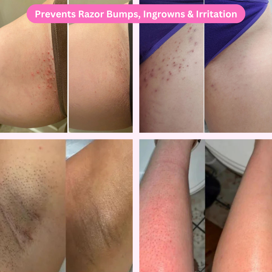 PetalSmooth Shave Pro 2.0