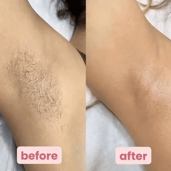 PetalSmooth™ Trimmer Pro