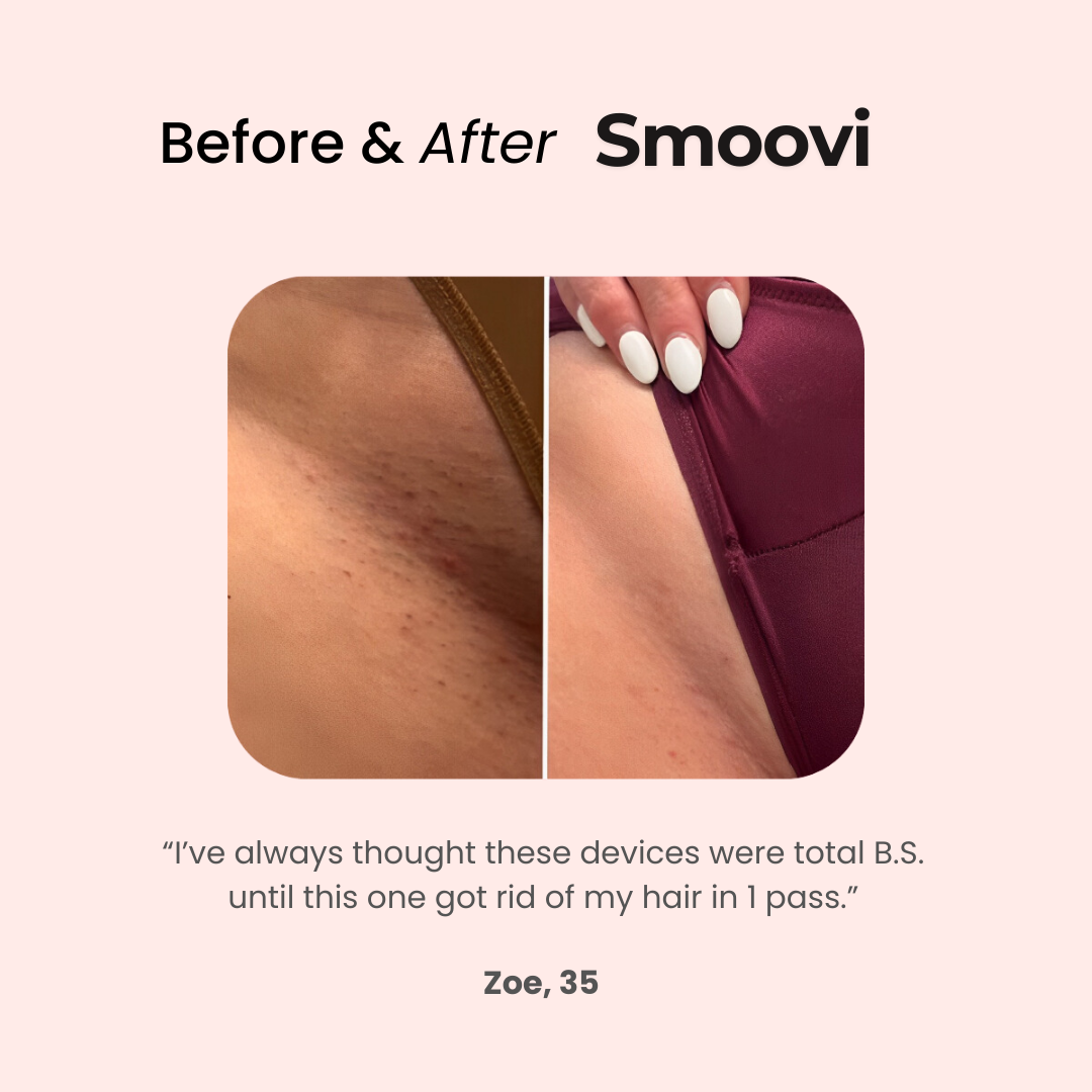 PetalSmooth™ SMOOVI 2.0